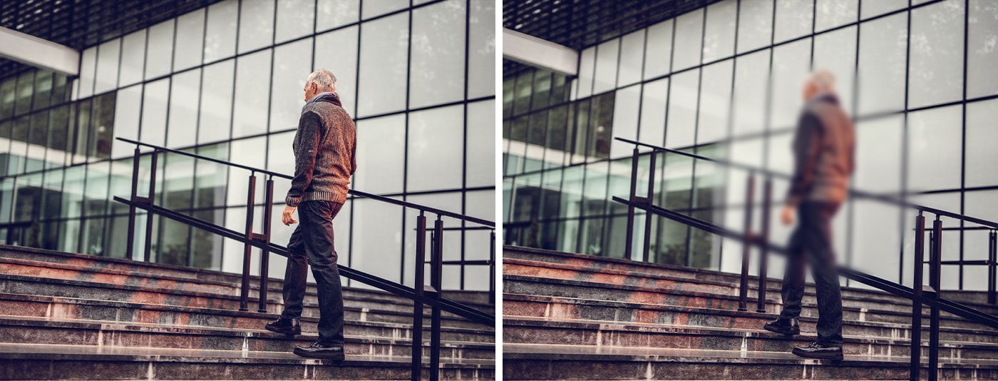 DMÖ-Symptom_kein_scharfer_Fokus