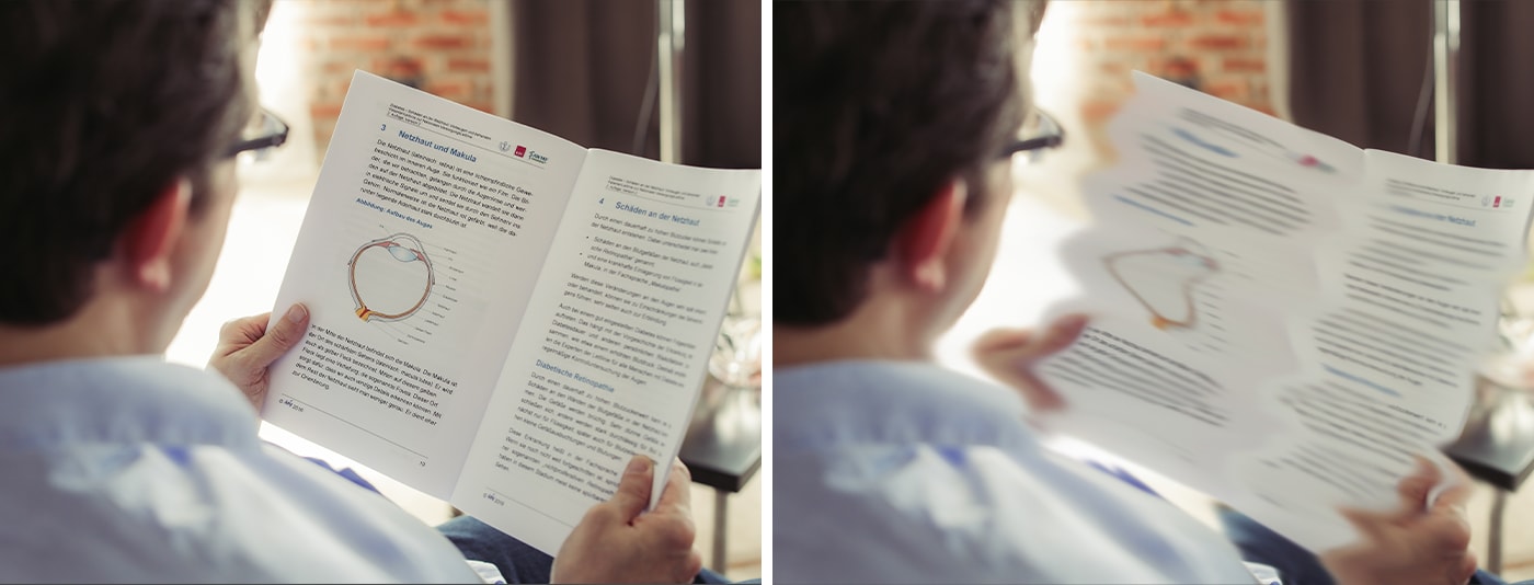 DMÖ-Symptom_metamorphopsien