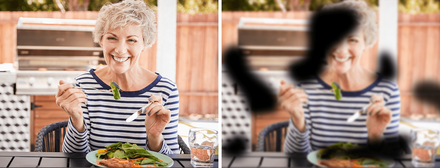 DMÖ-Symptom_Skotome